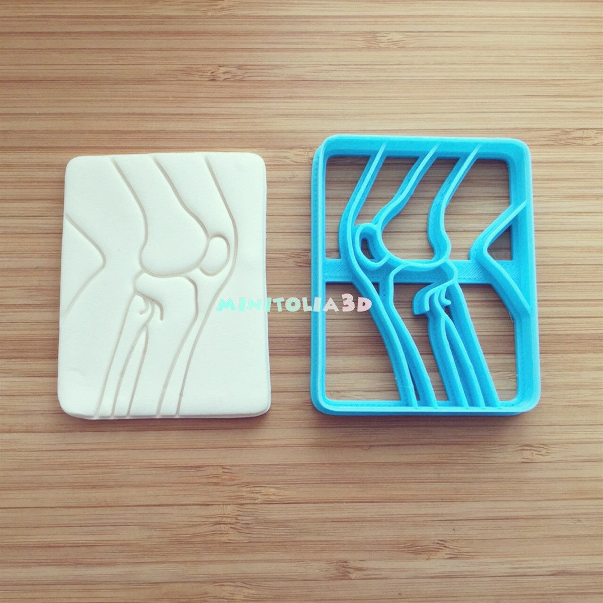 Ayak Kemik Röntgeni